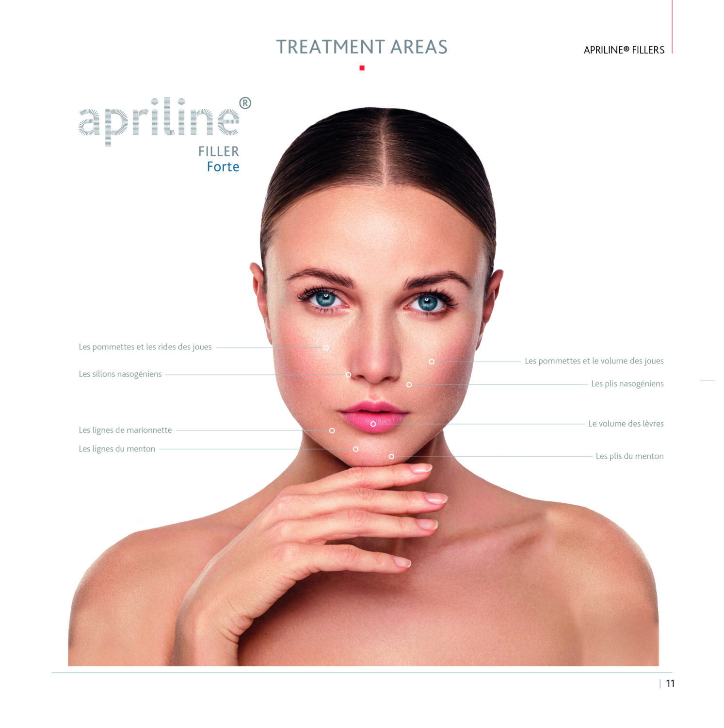 Forte filler - treatment areas
