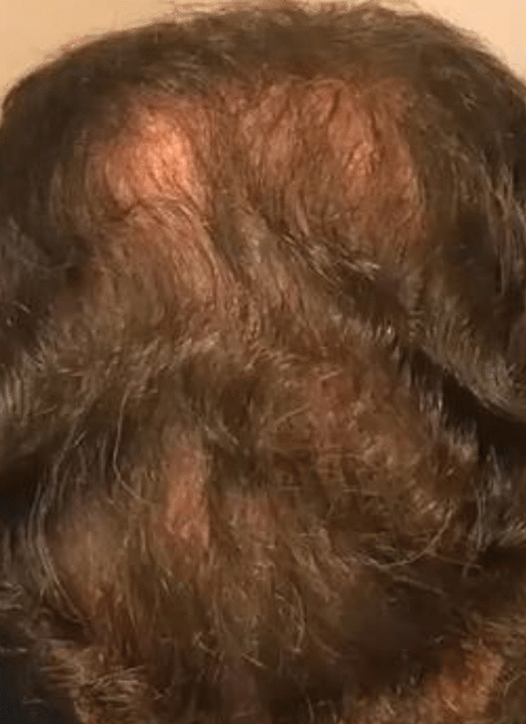 cellbooster-hair-before-2